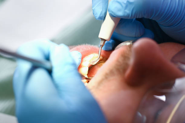 Best Pediatric Emergency Dentist in Warsaw, VA